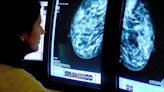 Women should begin breast cancer screenings at 40, USPSTF recommends