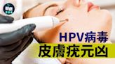 皮膚病｜HPV病毒 皮膚疣元凶