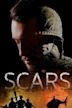 Scars