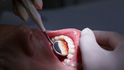 Gum disease: causes, risks, prevention and when to see your dentist