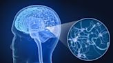 Esclerosis Múltiple: por qué es necesario un abordaje integral más allá de lo médico-farmacológico