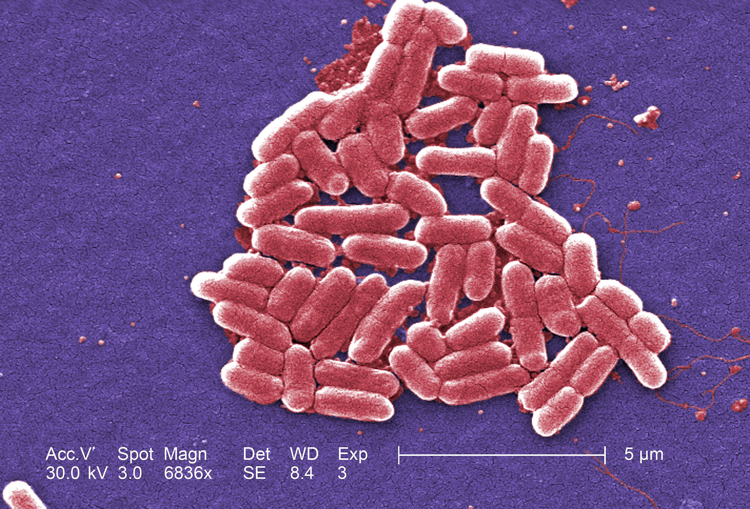 What we still don't know about the UK's E. coli outbreak