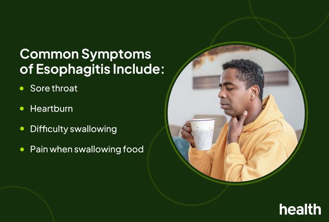 Signs and Symptoms of Esophagitis