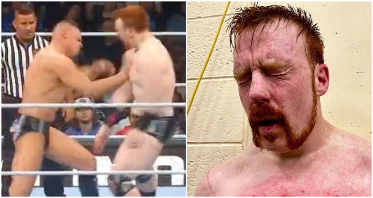 Sheamus' chest after fighting Gunther on Monday Night Raw proves how brutal WWE can be