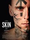 Skin | Drama