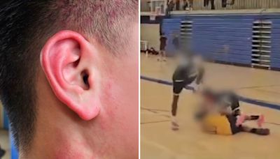 EXCLUSIVE: 13-year-old basketball player stomps on opponent's head during Bay Area game