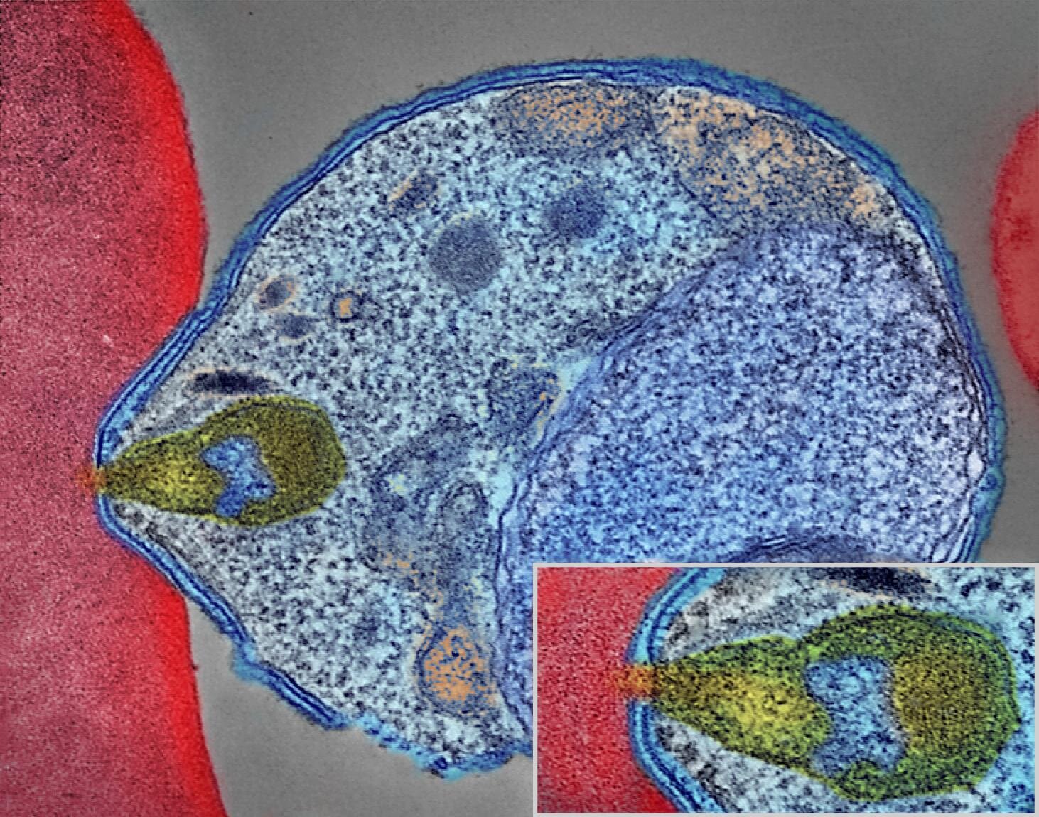 Deeper understanding of malaria parasite sexual development unlocks opportunities to block disease spread