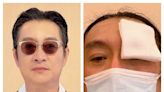 黃安才醫好眼睛又自曝受寒「失聲」 台灣中醫說話了：可能只是新冠