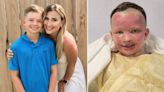 Boy left disfigured after aerosol can was thrown into fire and it exploded