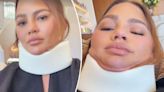Chrissy Teigen wears neck brace ahead of Met Gala 2024 — here’s what happened