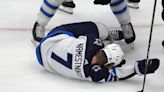 Jets forward Vladislav Namestnikov suffers a fractured cheekbone after a puck hit him in the face