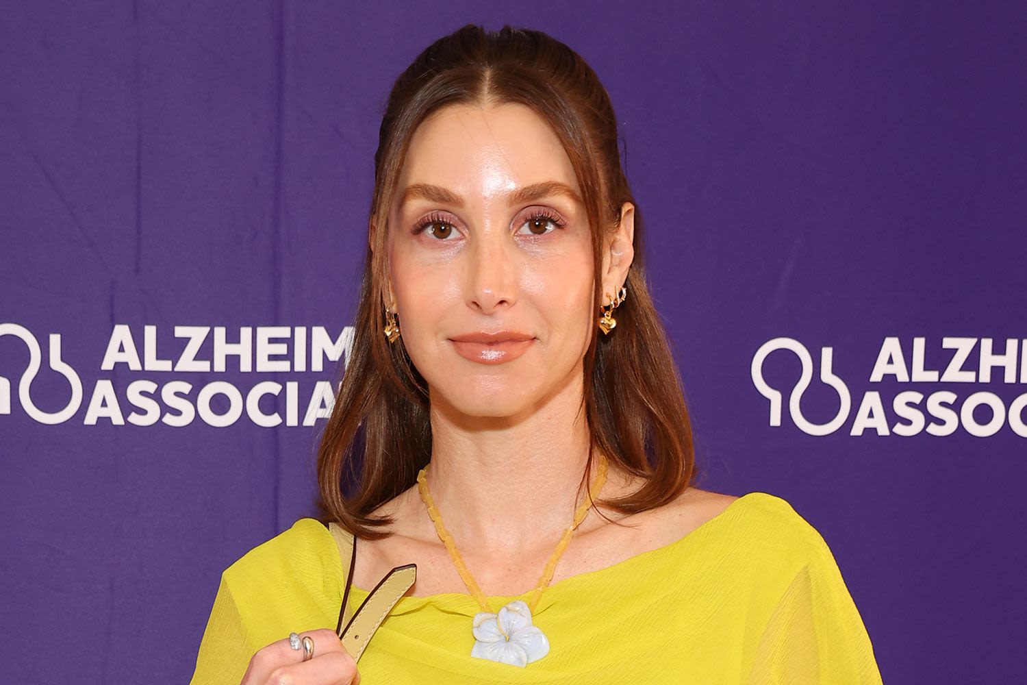 Whitney Port Gives 'Honest Update' on Fertility Journey Ahead of IVF Egg Retrieval