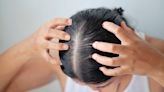 Scalp Massages Really Do Promote Hair Growth — Here’s Why (and How To Do Them Correctly)