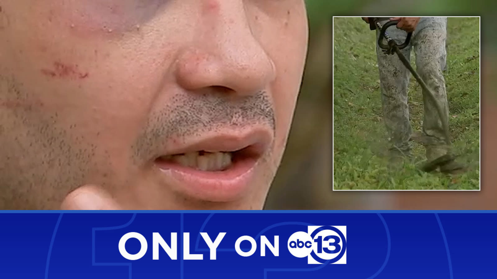 Victim claims 3 landscapers attacked him as he sought insurance info after SE Houston fender bender