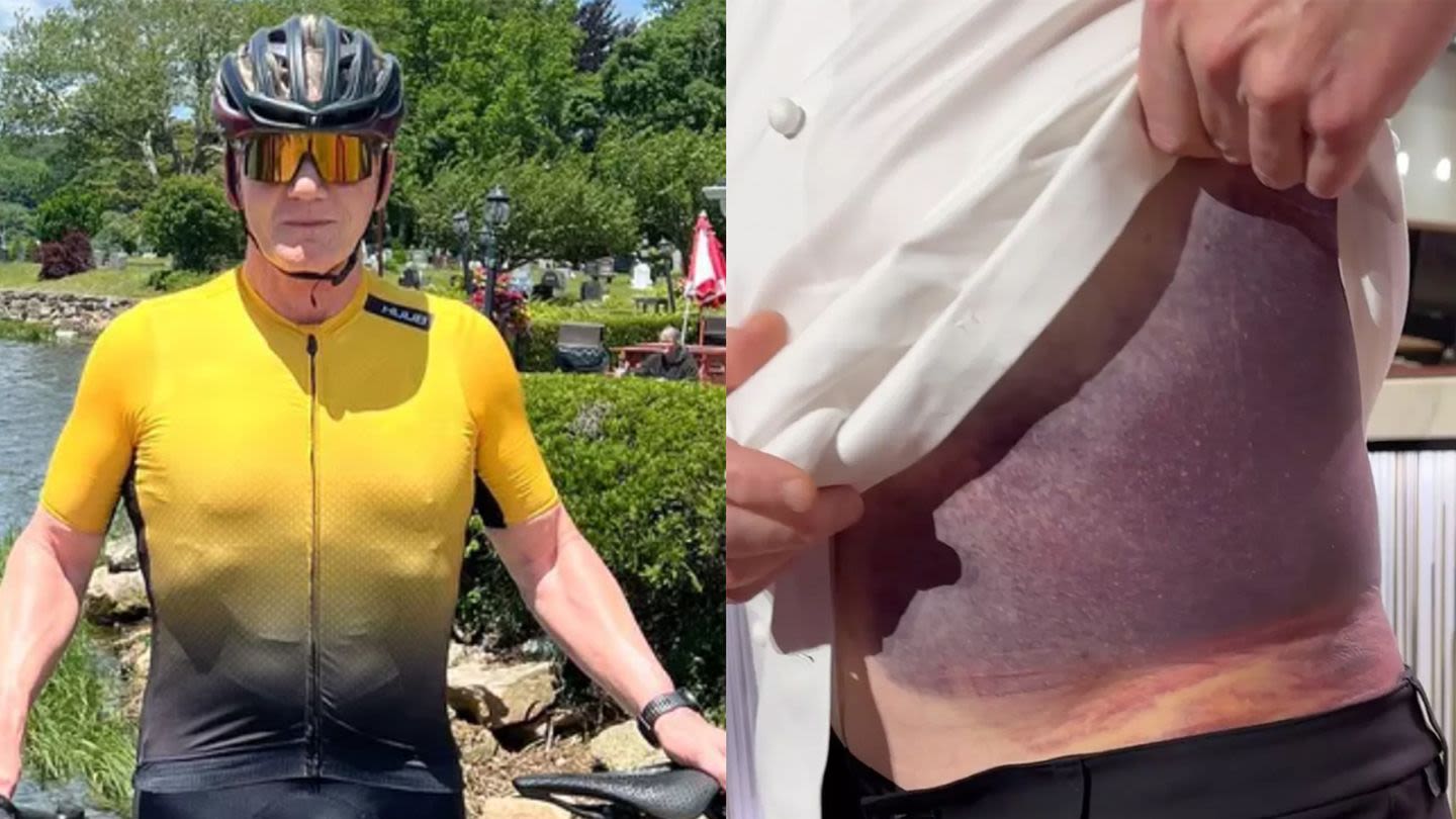 Gordon Ramsay Says He’s Lucky to Be Alive After Terrifying Bike Accident