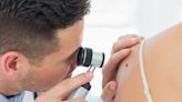 Skin cancer risk increases depending on where you live in Canada: Study