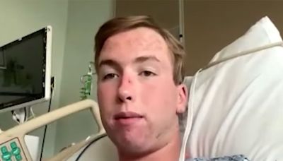 Florida Teen Recalls Waking Up in Puddle After He Was Knocked Out by Lightning