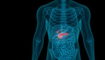 14 síntomas de cáncer de páncreas que pueden pasar desapercibidos