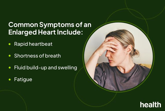 Signs and Symptoms of an Enlarged Heart (Cardiomegaly)