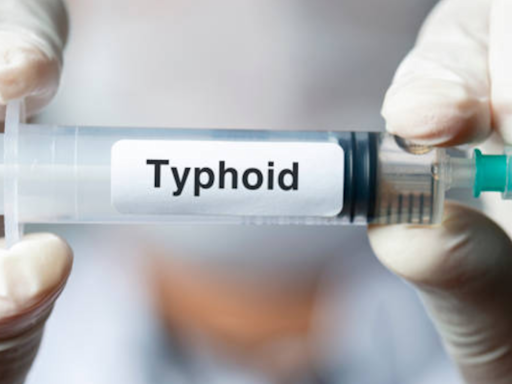 Rapid rise in typhoid cases: How to know if your fever is typhoid - Times of India