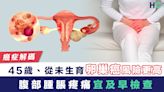 【癌症解碼】45歲從未生育女性患卵巢癌風險更高！腹部腫脹疼痛宜及早檢查