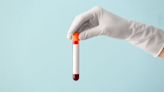 Cytovale’s sepsis diagnostic test demonstrates 97.5% NPV in latest study