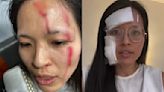 Asian woman 'needs her city back' after violent attack in NYC