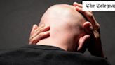 ‘It made my penis change shape’: Inside the hair loss drug controversy