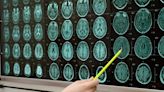 Council Post: How Misinformation Could Be Threatening The Future Of Brain Research