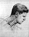 Autopsy of John F. Kennedy