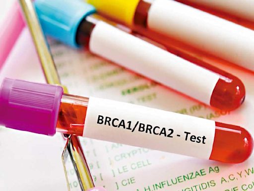 免費BRCA基因檢測 找靶點精準治療 | am730