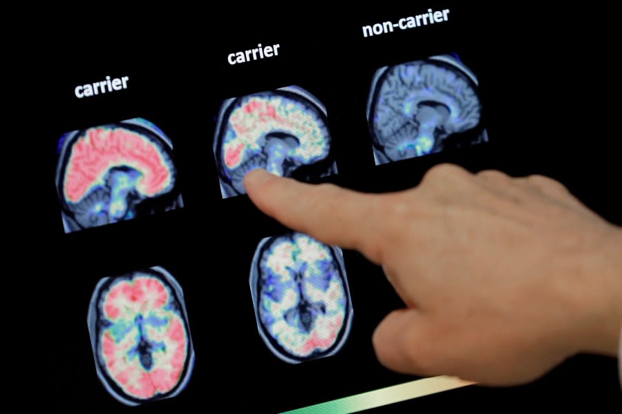 U of M, MSU to expand neurology services in Lansing