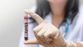 伊波拉病毒是什麼？平均死亡率高達五成！伊波拉病毒症狀有哪些？台灣人該如何預防？