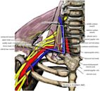 Thoracic outlet syndrome