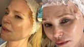 Christie Brinkley undergoes skin cancer surgery after revealing diagnosis