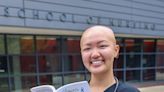 'Ignore the haters': Marlboro woman with alopecia lost hair but found a community