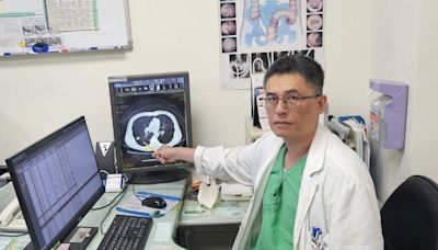 50歲男排便「裡急後重」就醫發現同時罹腸癌、肺癌 - 自由健康網