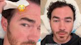 Kevin Jonas preocupa al revelar que fue operado por un cáncer de piel