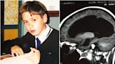 When I heard my son had a benign brain tumor at 11, I thought that meant it was harmless. I was wrong.