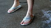 What’s with all the Kansas City guys in shorts and sandals during freezing weather? | Opinion