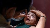 What to know about the polio vaccine and why most people aren't at risk of infection