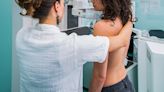 Routine Breast Cancer Screening Should Start at 40: USPSTF