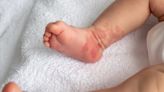 ¿Qué relación hay entre los antojos de una mujer embarazada y las manchas rojizas del bebé?