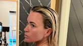 Teddi Mellencamp Says Her Melanoma Is Gone After Surgery, Vows to Be 'Diligent' With Her Skin Checkups