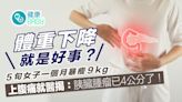 胰臟癌｜中年婦1個月暴瘦9kg胰臟現腫瘤！4高風險族群應特別留意