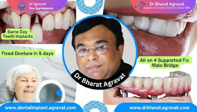 Best Dentist for Full Mouth Dental Implants Clinic in Ahmedabad: Dr. Bharat Agravat, the top Implantologist