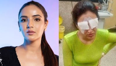 Jasmin Bhasin Is 'Feeling Worst' Due To Corneal Damage, Talks About 'Excruciating Pain and No Vision' - News18