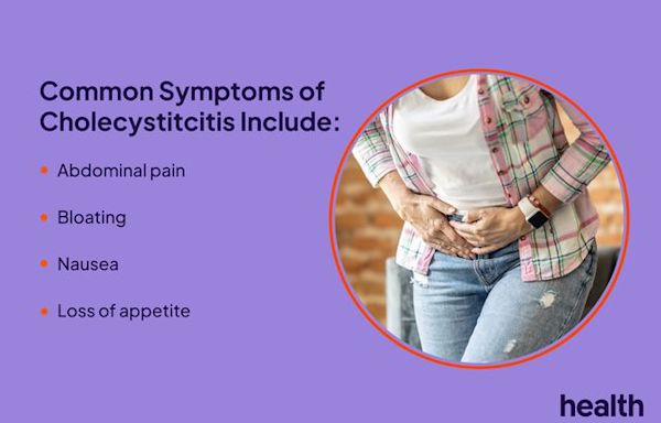 Signs and Symptoms of Cholecystitis (Gallbladder Inflammation)