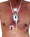 Holter monitor