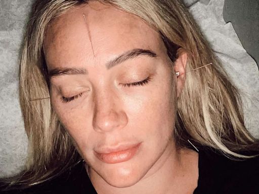 Pregnant Hilary Duff Gets Acupuncture as She Says She's 'Gently Trying to Give Baby the Eviction Notice'